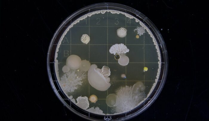 Bacteria under microscope, for article on van leeuwenhoek microscope