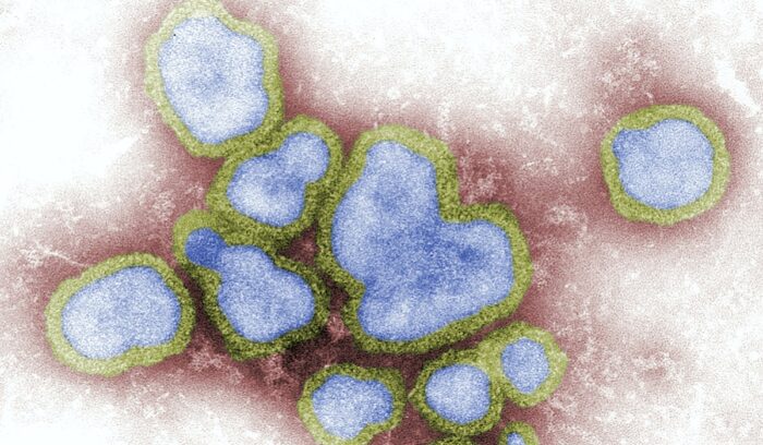 Viruses under microscope, for article on RSV vaccine approval